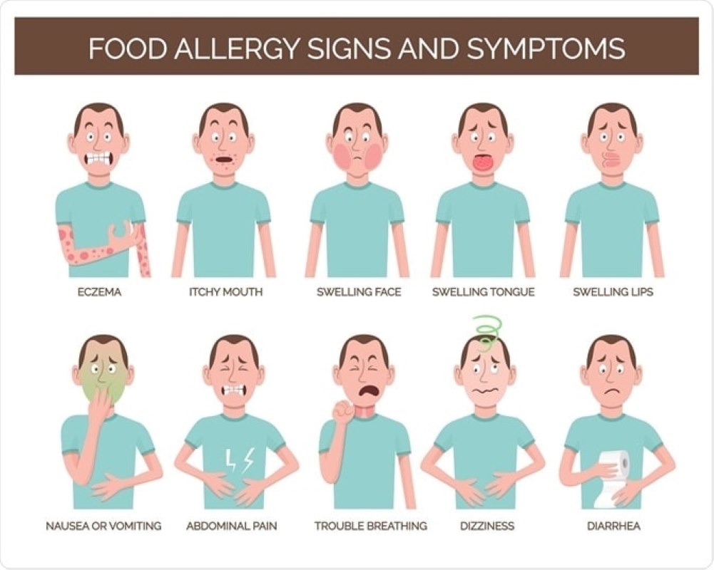 Different types of allergic reactions to food