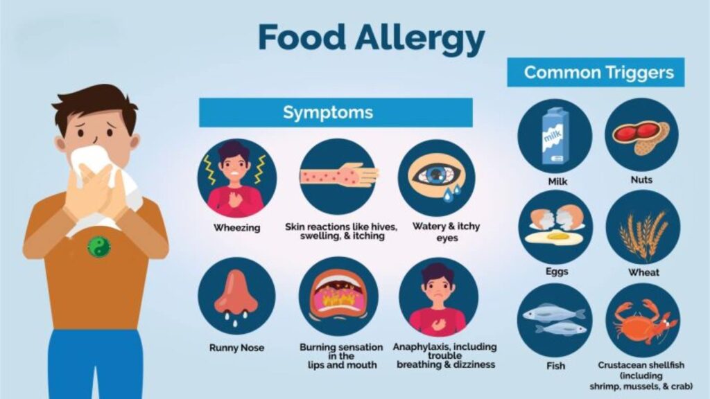 Food allergies are common medical conditions