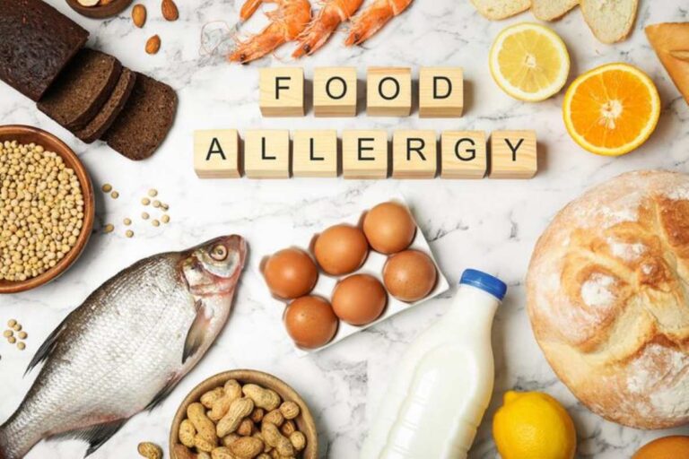 A poster for food allergy awareness week