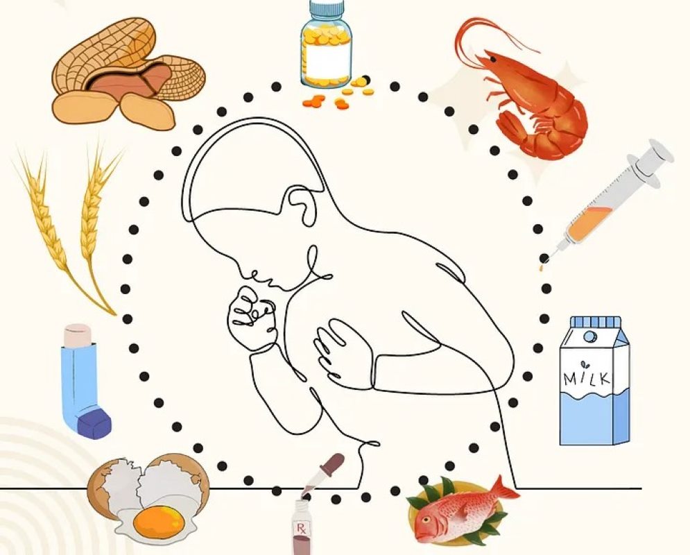 Infographic on the causes, symptoms, diagnosis, and treatment of food allergies.